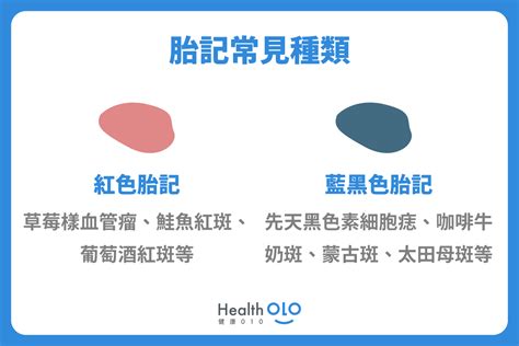 新生兒屁股胎記|胎記怎麼產生、何時消除？醫師剖析胎記種類、胎記寓意